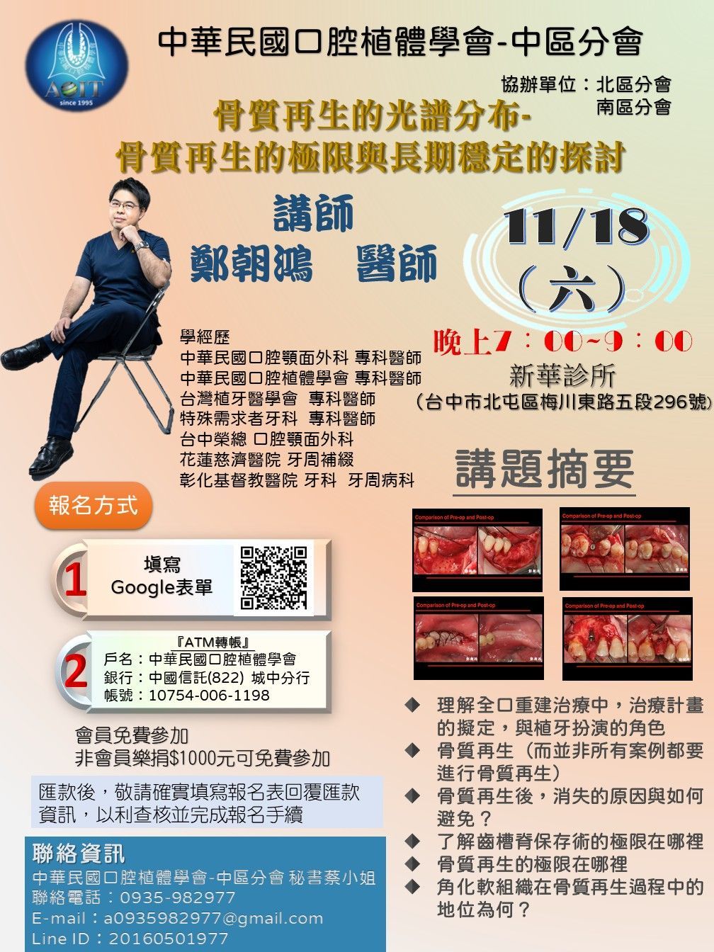 dentalimplant