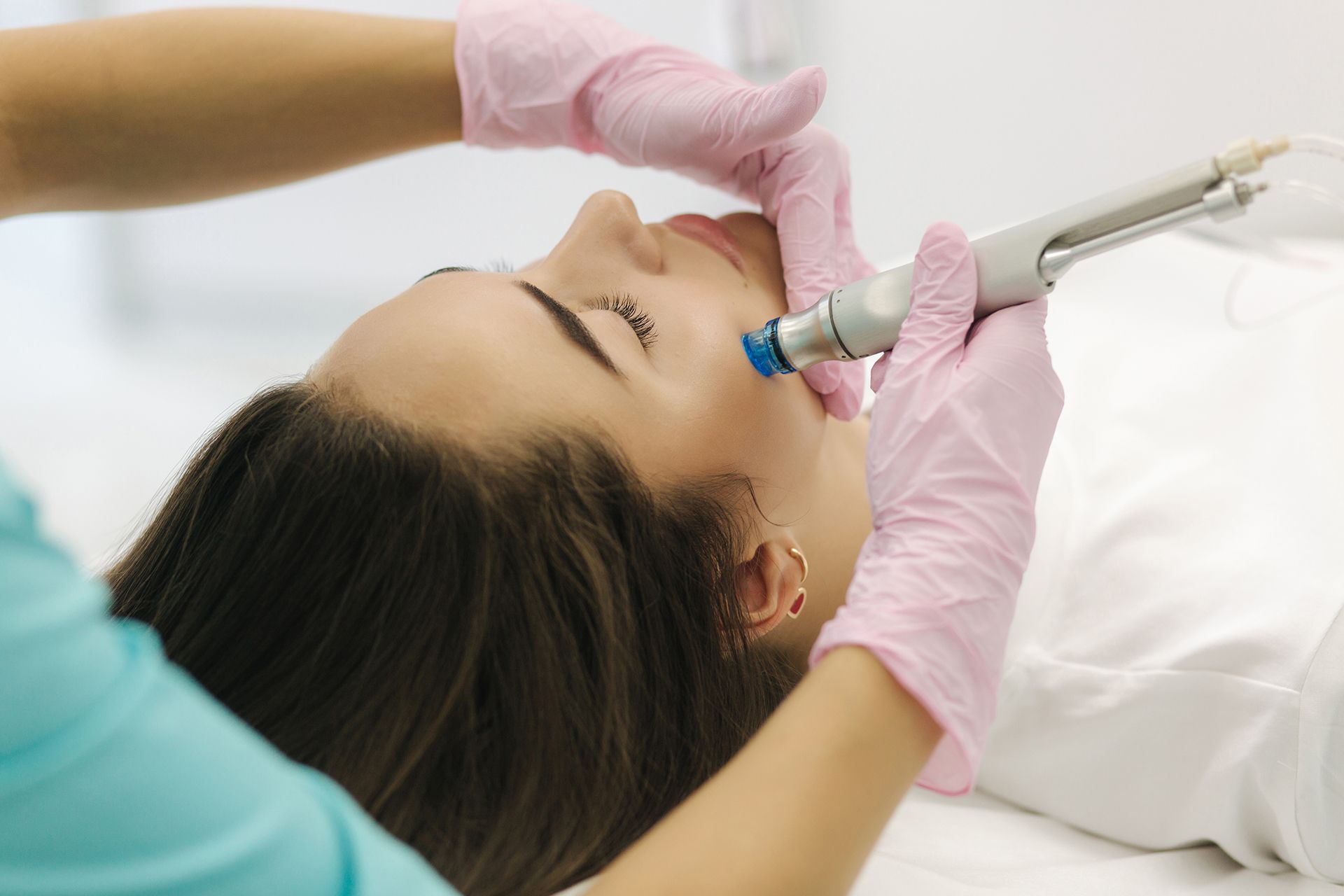 Microdermabrasion Peeling Treatment