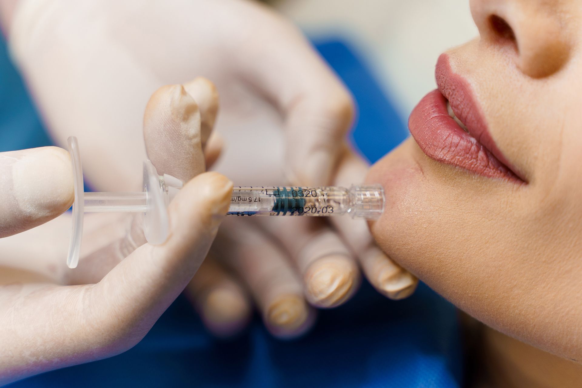 Botox Injection on Chin