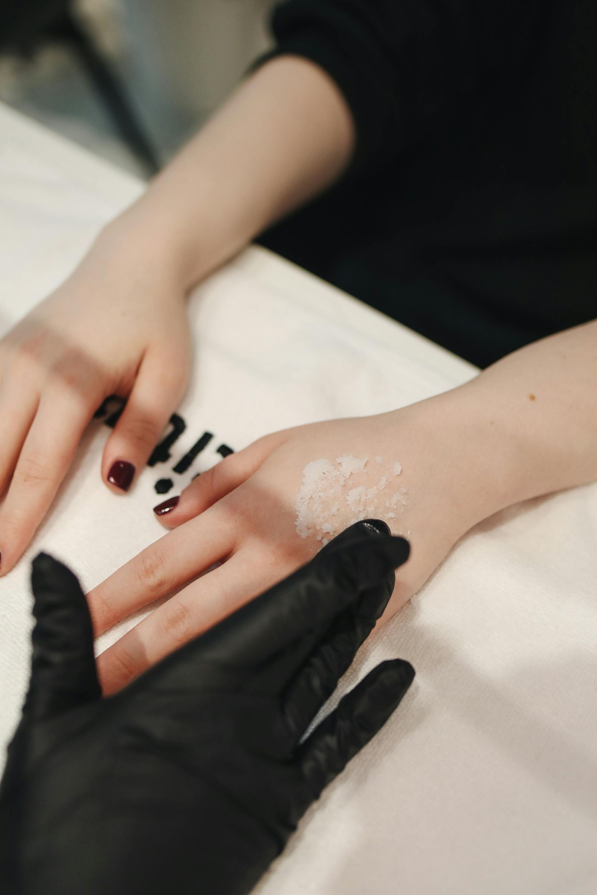 Hand with light-colored cream being treated by a gloved hand on a white surface.