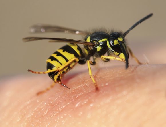 Image of Wasps in Human Skin — Billings, MT — Action Pest Control