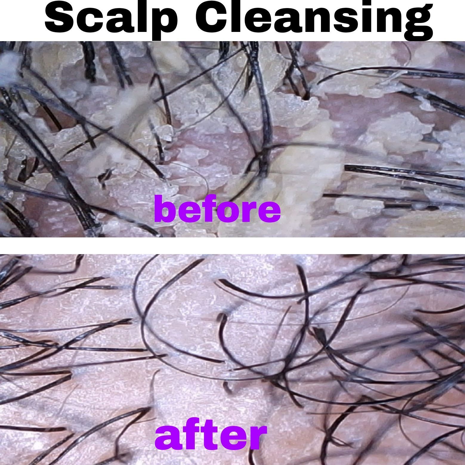 before and after of a closeup of a scalp that has benefitted from miks kreations