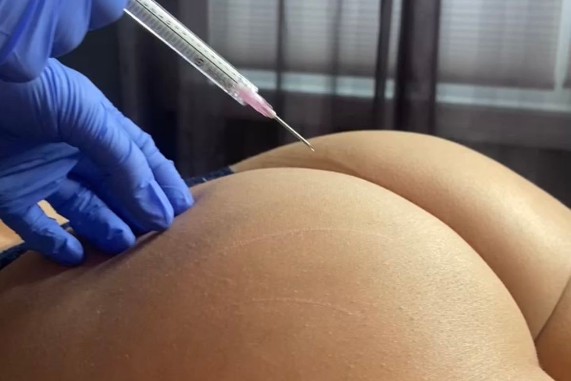 A woman's butt with a needle next to it