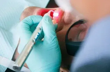 Dentist working on patients teeth
