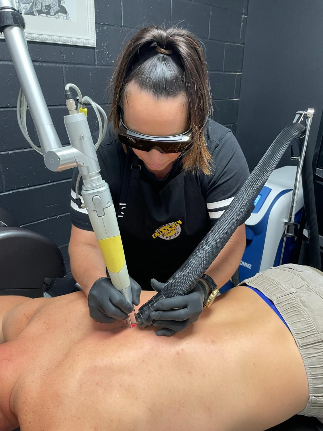 A Woman is Using a Machine on a Man 's Back — Gallery Tattoo in Medowie, NSW