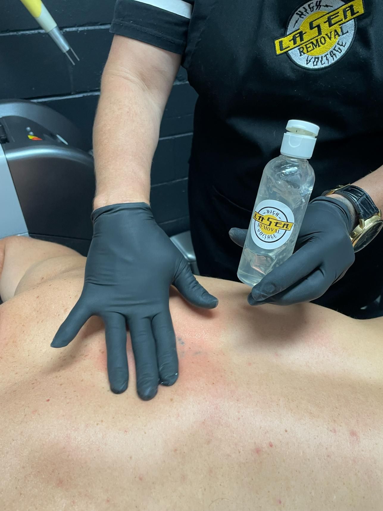 A Person Wearing Black Gloves is Holding a Bottle of Hand Sanitizer on a Man 's Back — Gallery Tattoo in Medowie, NSW