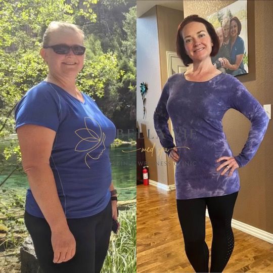 A before and after photo of a woman in a blue shirt