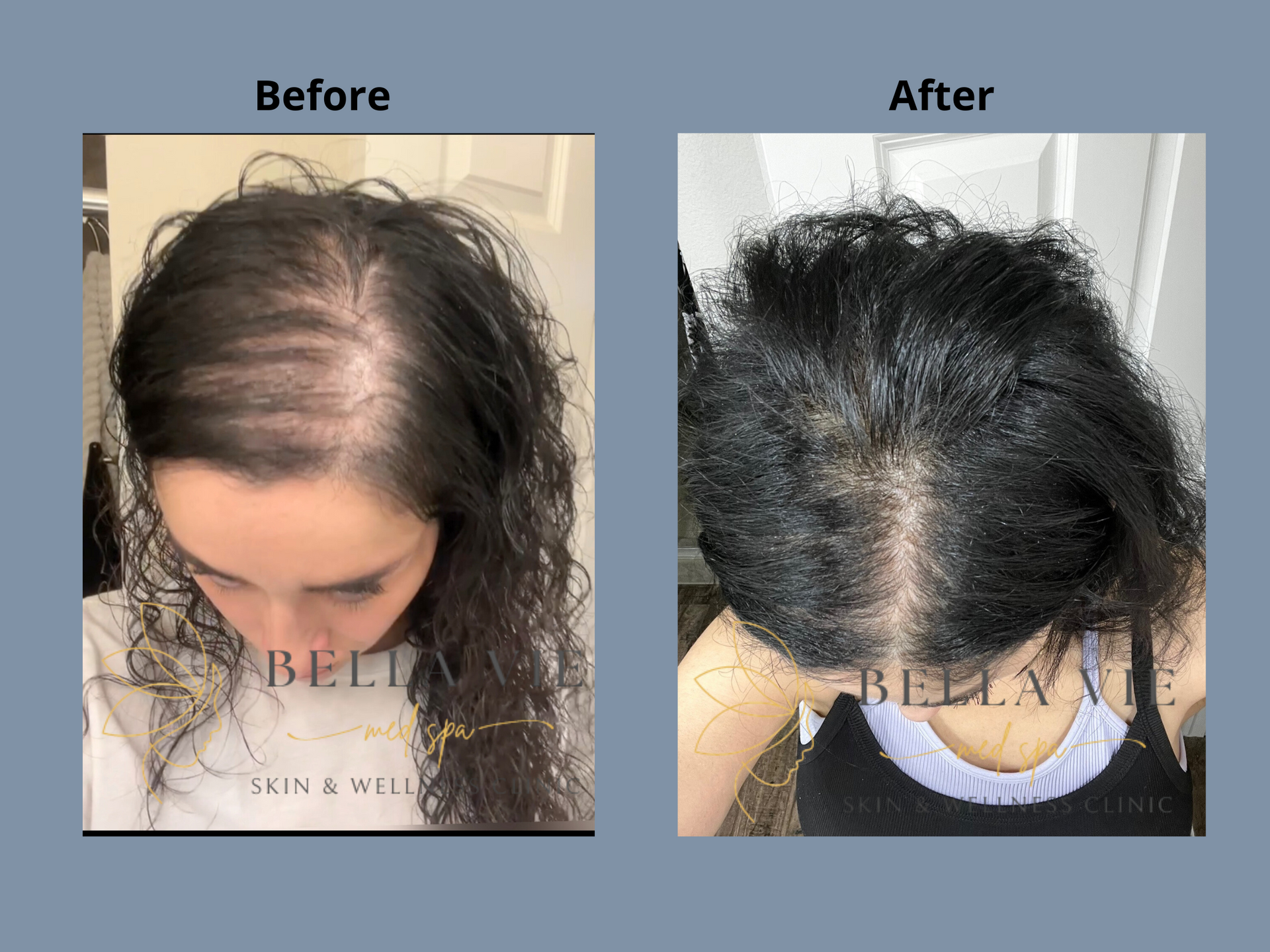 A before and after photo of a woman 's hair growth.