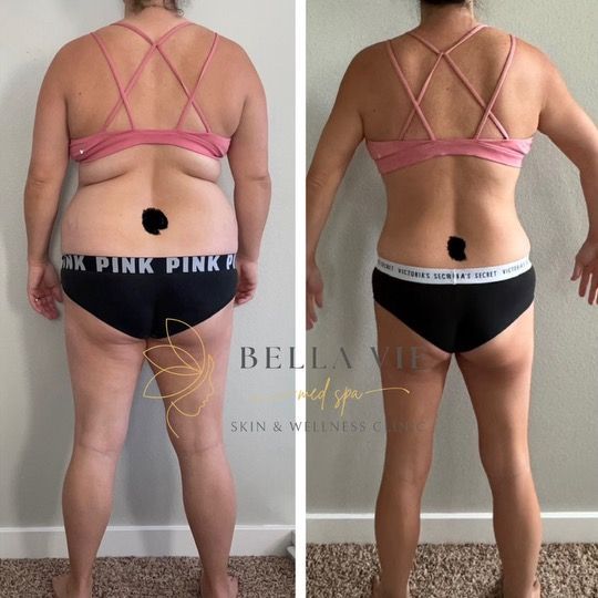 A before and after photo of a woman wearing pink pinka underwear