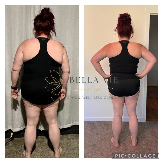 A before and after photo of a woman with bella vie written on the bottom