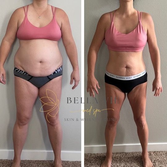 A before and after photo of a woman 's body