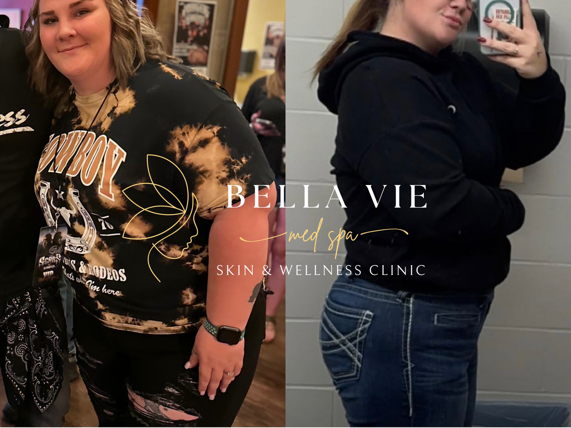 A woman is taking a picture of herself before and after losing weight.