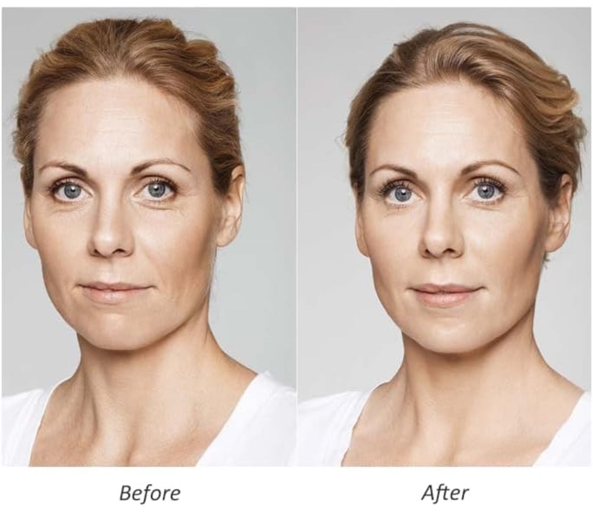 A before and after photo of a woman 's face