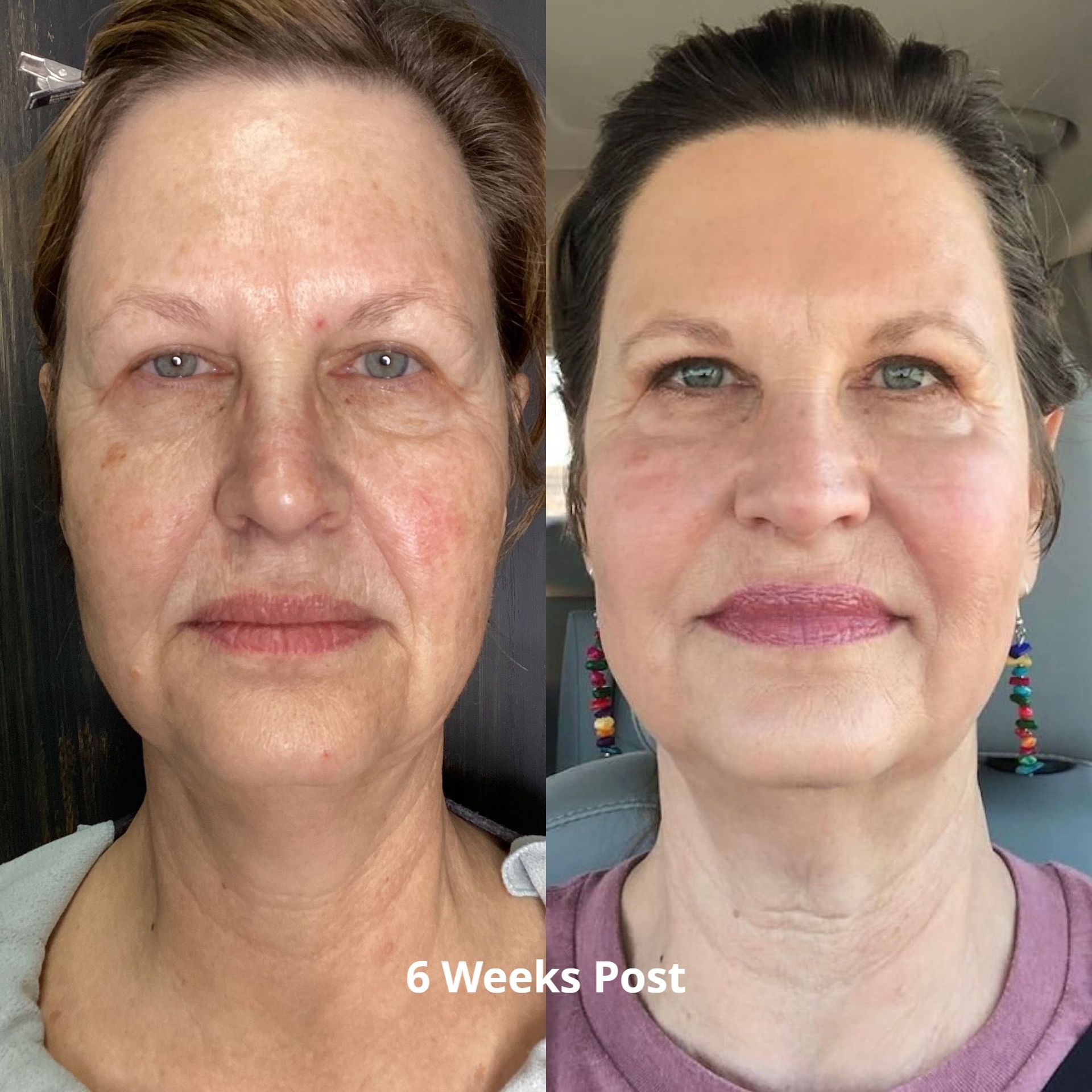 a before and after photo of a woman 's face