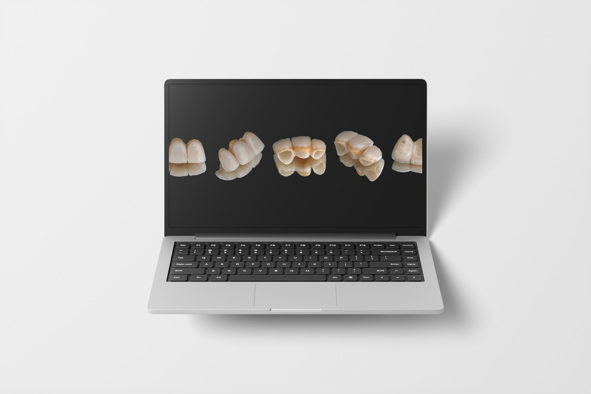 Laptop displaying various dental crowns on a black screen.