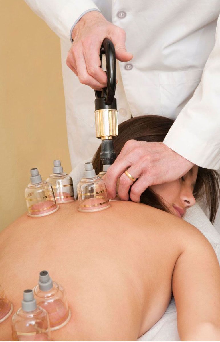a woman is getting a cupping treatment on her back