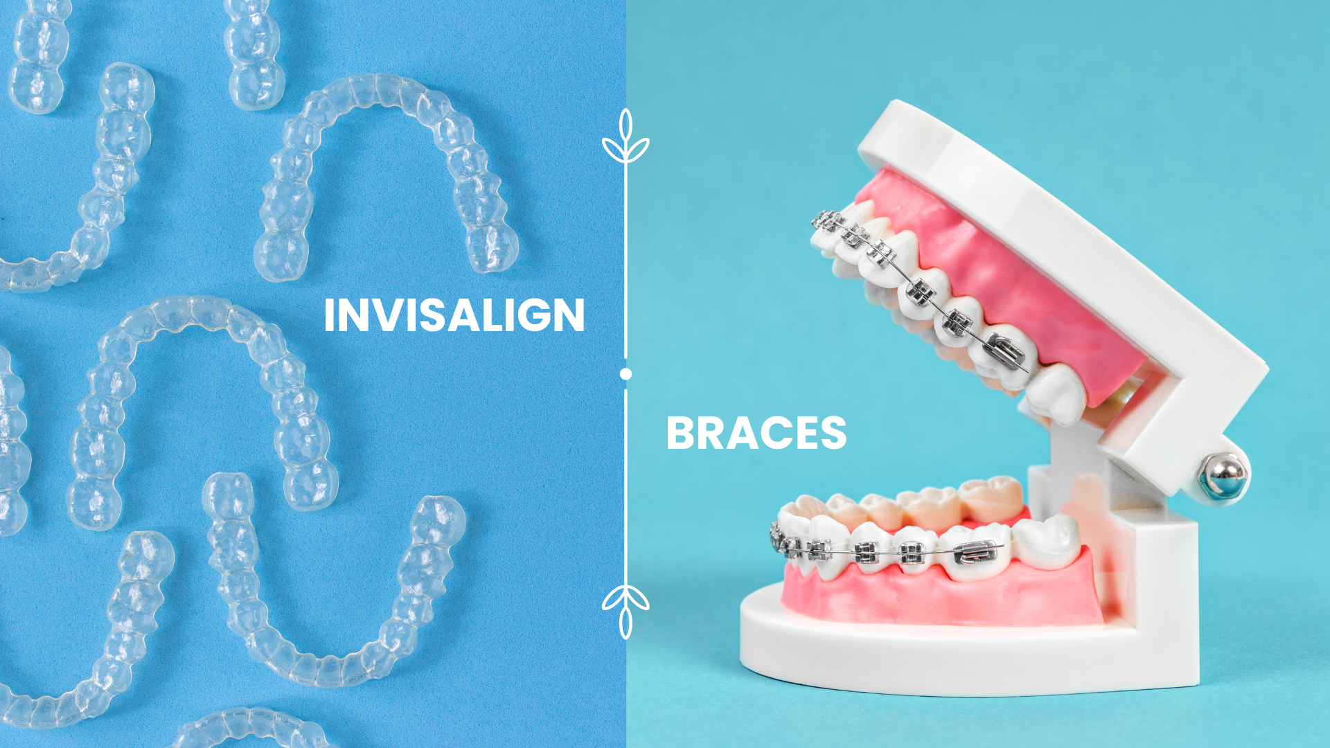 Choosing the Best Path to a Brighter Smile: Invisalign vs. Braces – Which Works Faster