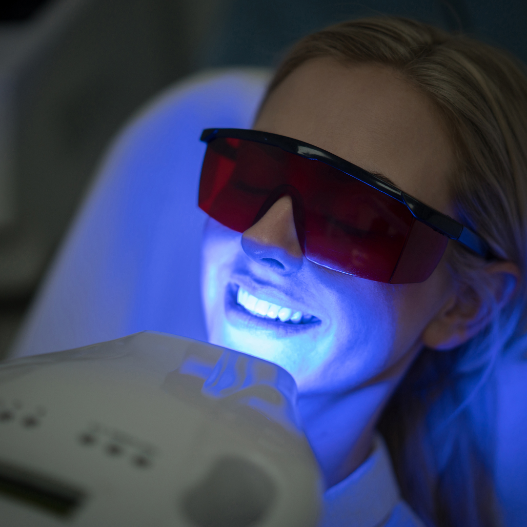 Woman in dental chair with protective glasses, receiving teeth whitening treatment.
