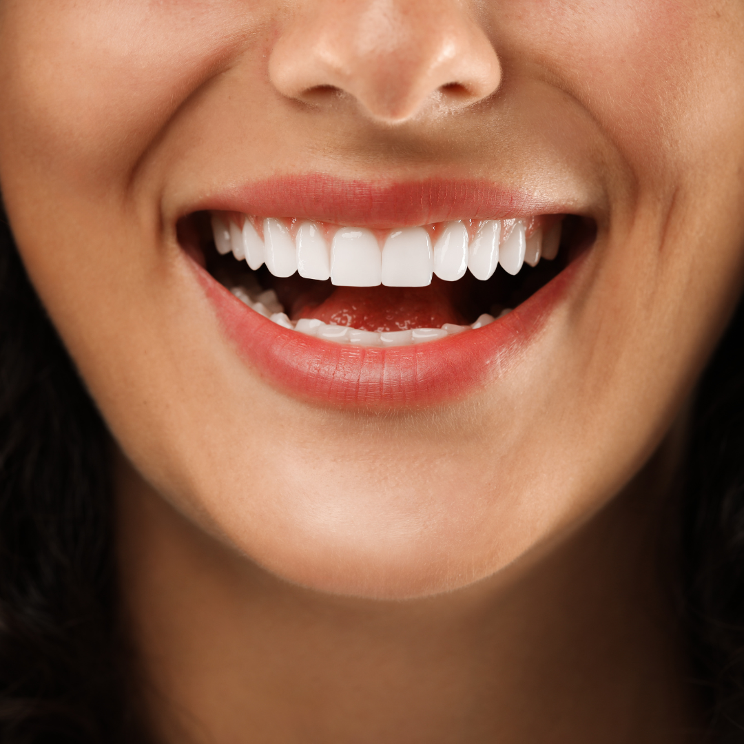 Woman smiling, showing bright white teeth and rosy lips.