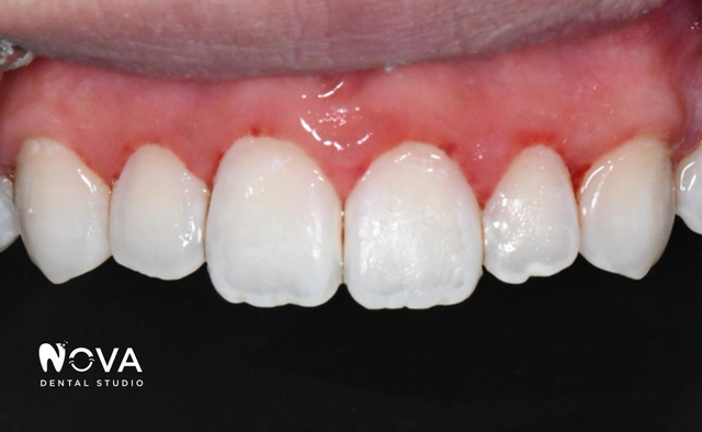 Our Work | Nova Dental Studio