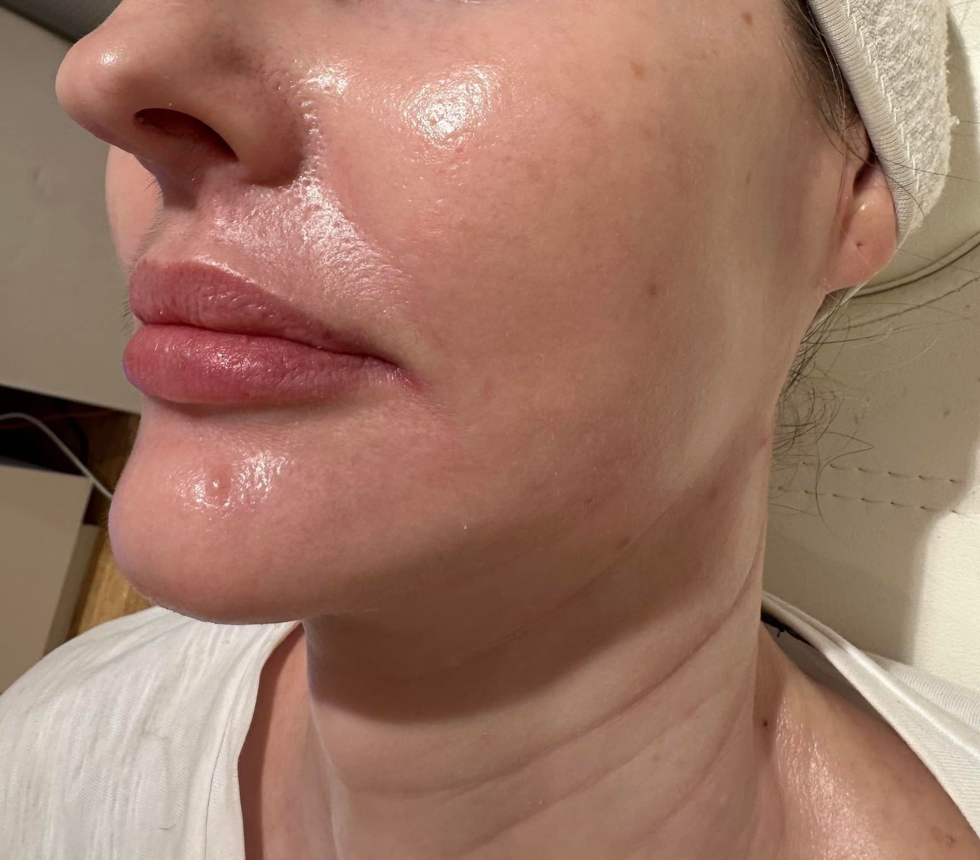 A Close Up of a Woman's Face With a Towel on Her Head — Townsville Anti Aging in Currajong, QLD