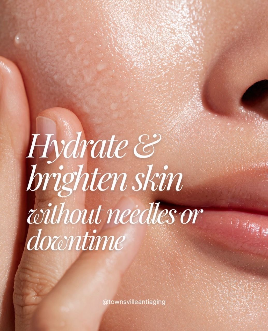 Woman posing with hands underneath her chin — Townsville Anti Aging in Currajong, QLD