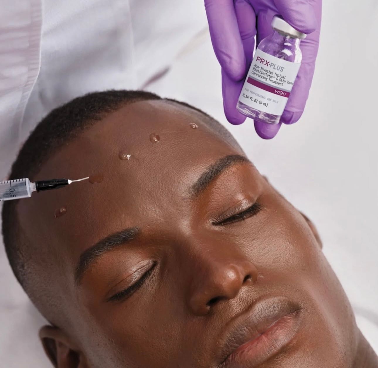 A Woman With Red Nails is Touching Her Face and Has Lines Drawn on Her Face — Townsville Anti Aging in Currajong, QLD