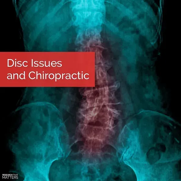 disc issues sun prairie chiropractor madison