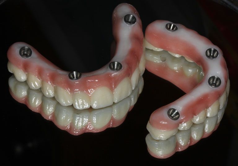 A pair of dentures are sitting on a black surface.