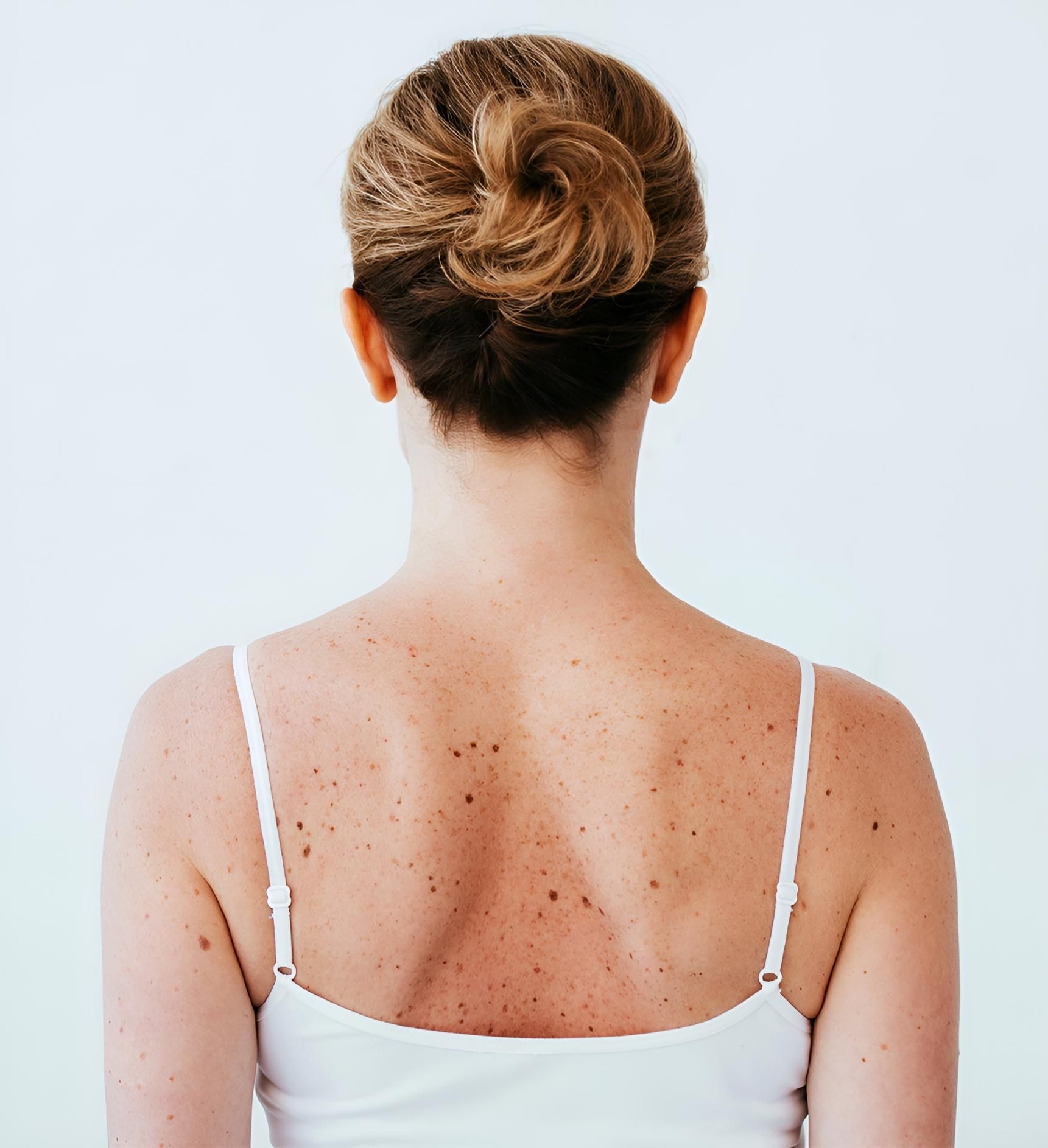 A Woman In A White Tank Top Has A Bun In Her Hair — HealthPoint Mingara In Tumbi Umbi, NSW