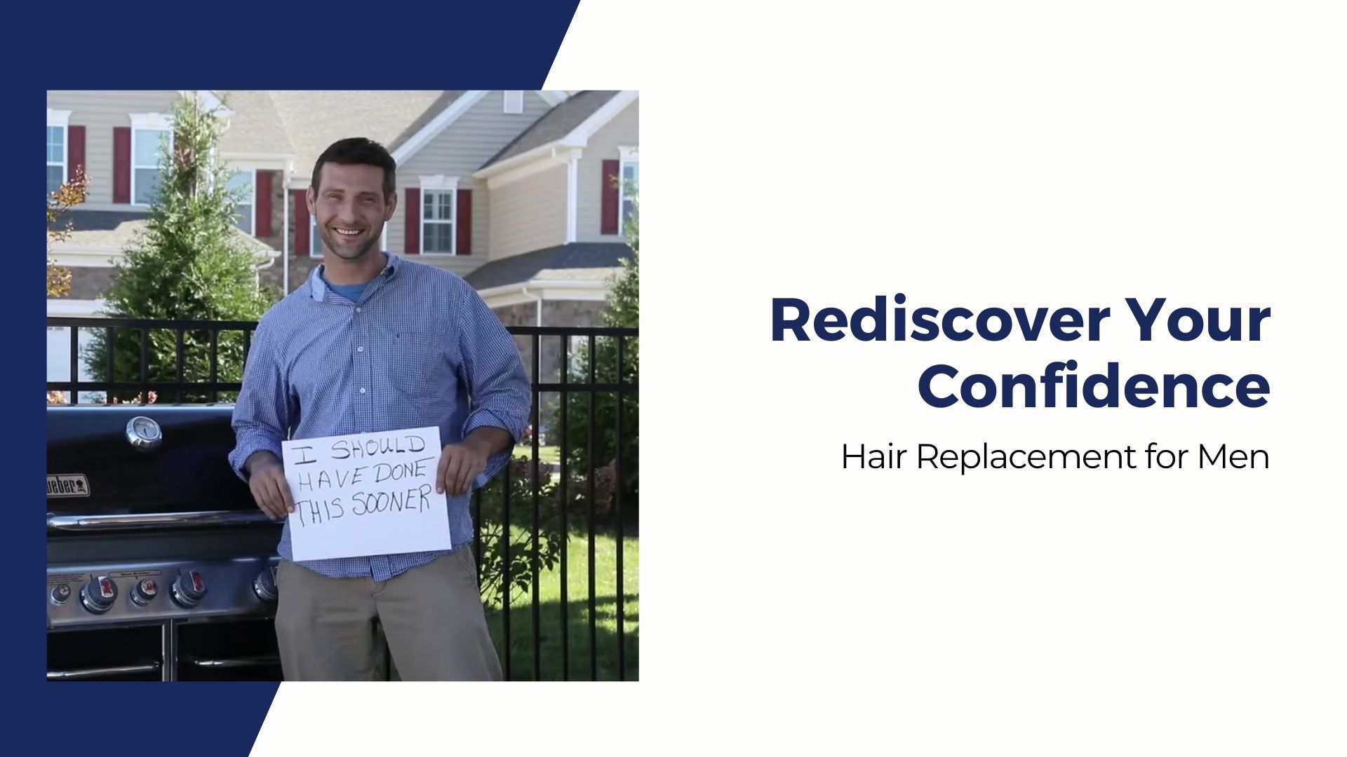 Rediscover Your Confidence: Hair Replacement for Men