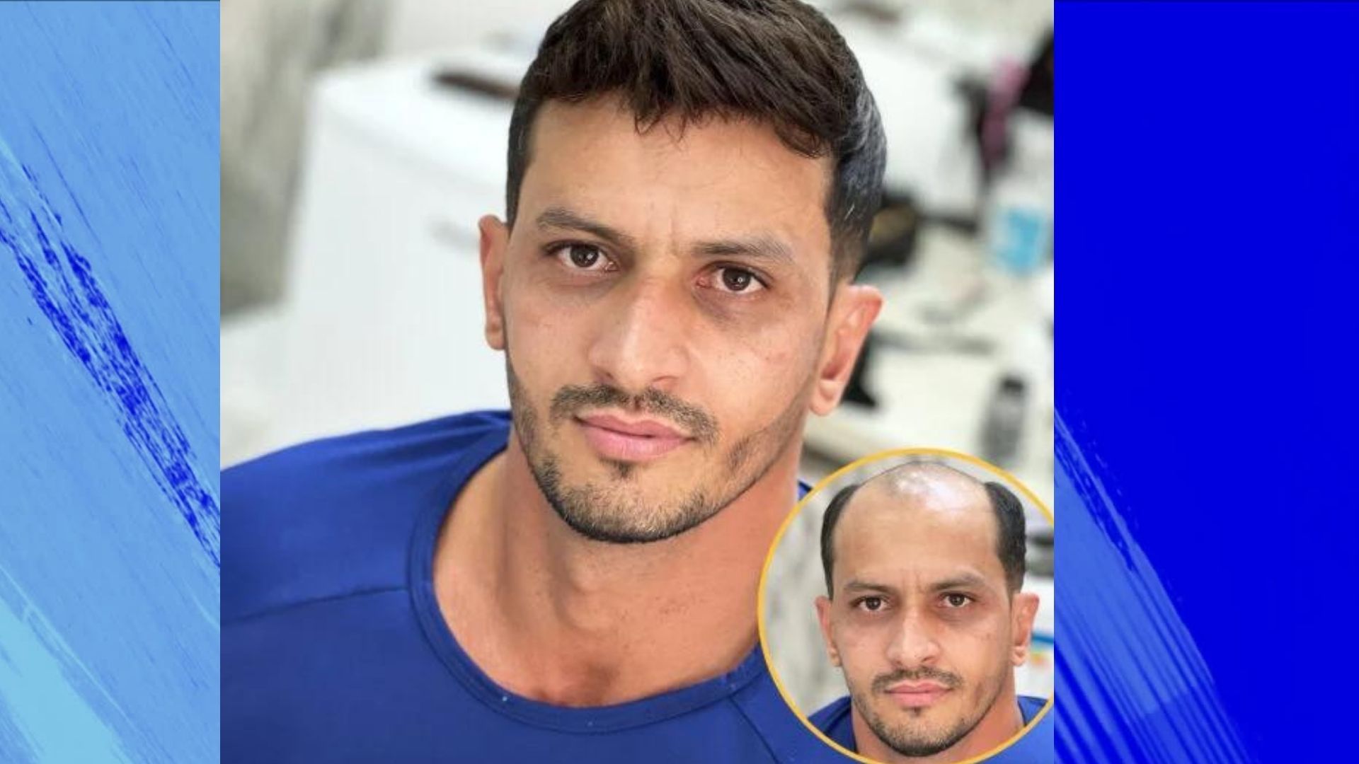 young male very stres