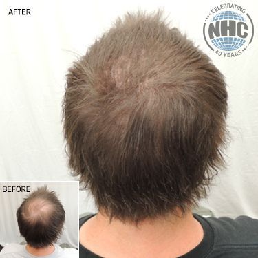 A before and after photo of a man 's hair