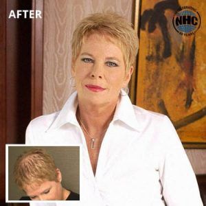 A picture of a woman 's hair before and after being restored by nhc