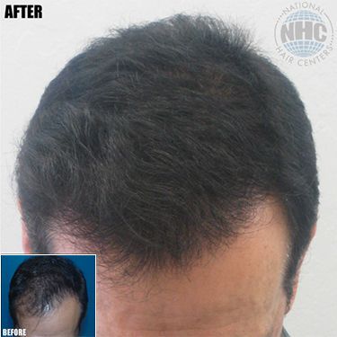 A before and after photo of a man 's hair