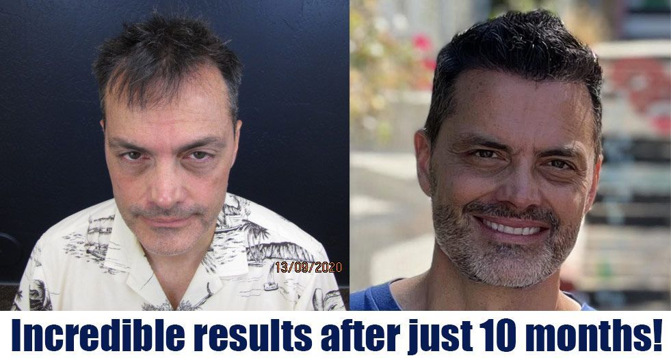 A before and after photo of a man with a beard.