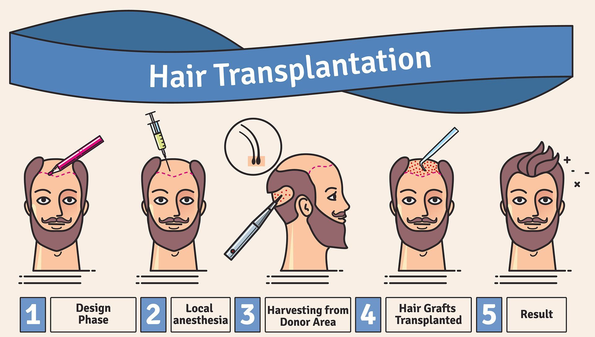 Hair Transplant Surgery | National Hair Centers Surgical