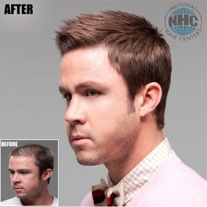 A before and after picture of a man 's hair