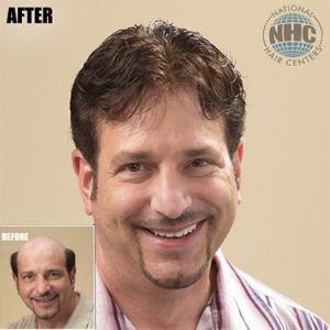 A before and after photo of a man with a beard