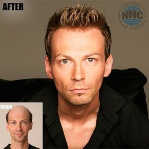 A before and after photo of a man with a beard