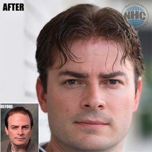 A before and after photo of a man 's face