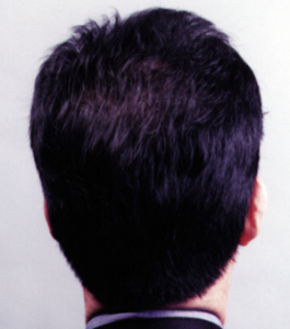 The back of a man 's head with dark hair