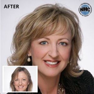 A before and after photo of a woman with nhc written on the bottom