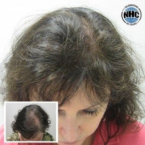 A woman with a before and after picture of her hair.
