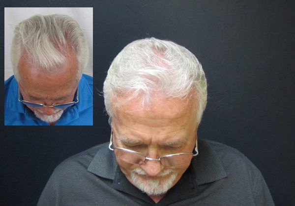 A before and after picture of a man 's hair