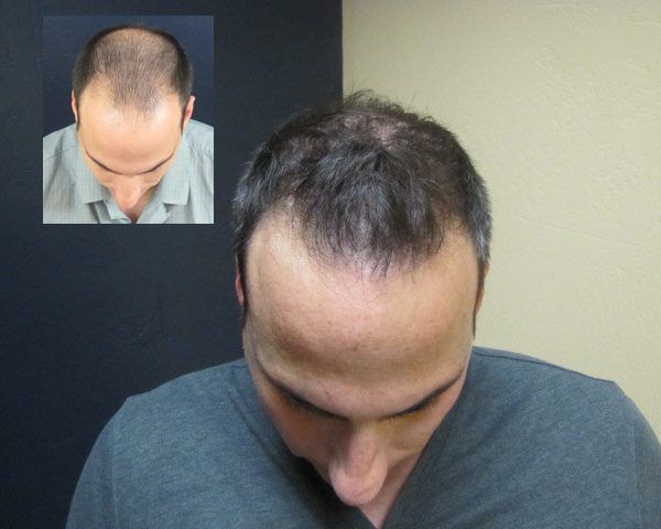 A before and after picture of a man 's hair