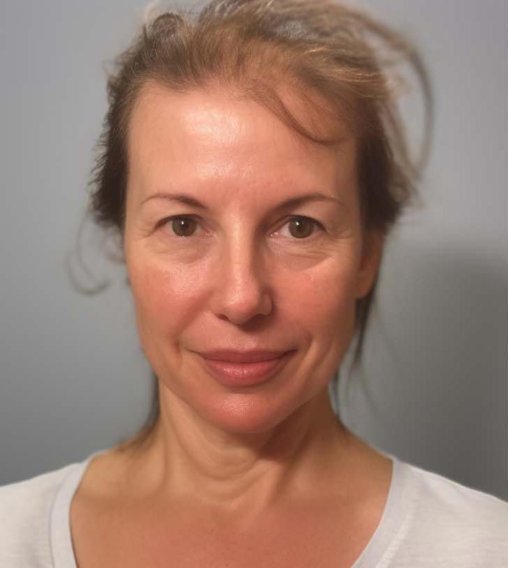 A close up of a woman 's face with a white shirt on.