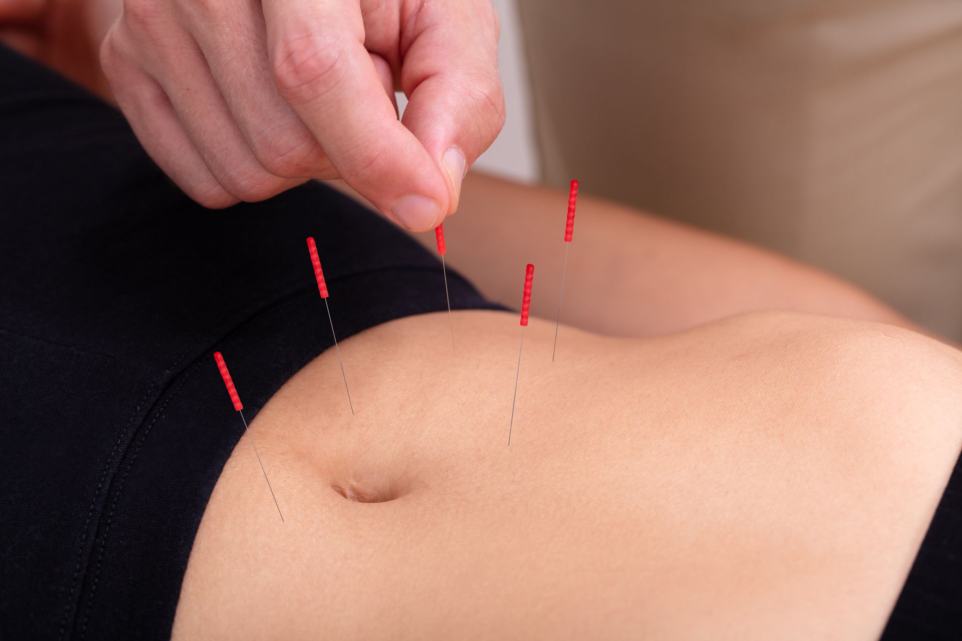 Professional Acupuncture Treatment