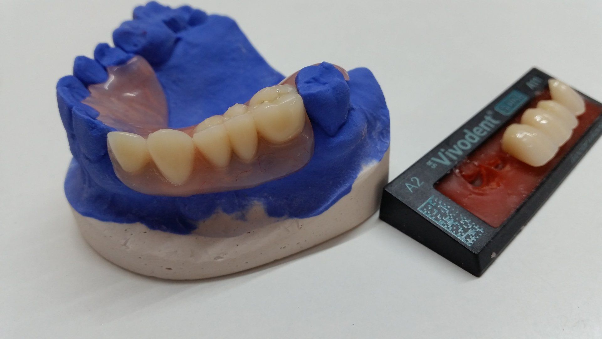 partial dentures in a blue mouth impression