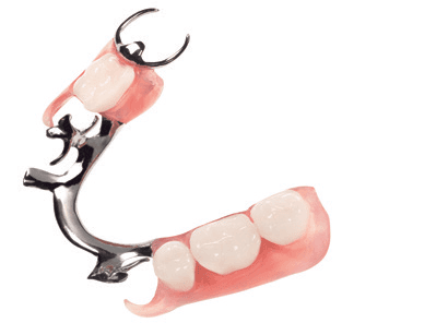 custom partial dentures